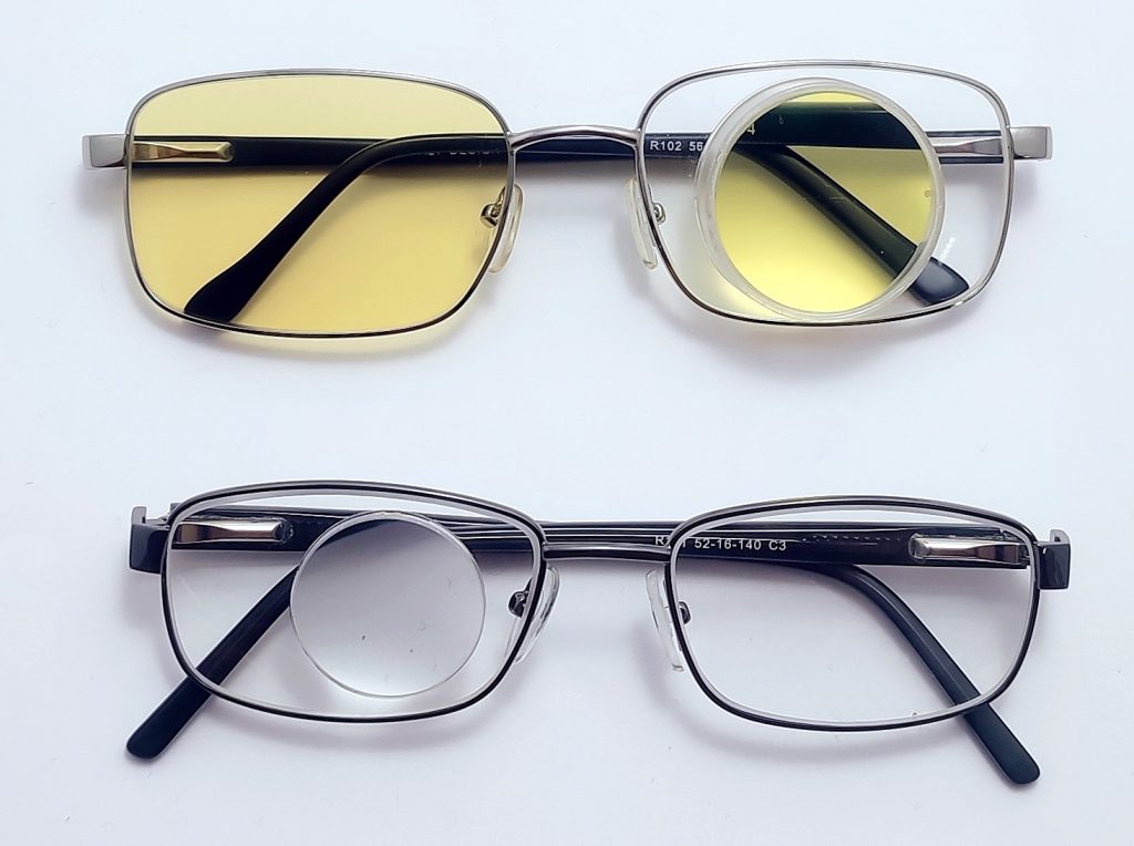 microscopio monocular y microscopio con filtro selectivo, es una ayuda óptica para pacientes con baja vision en valencia. Problemas en la macula usan este tipo de gafas para poder leer, pacientes con dmae, retinopatía diabética. Son gafas especiales que hacen más grandes las imágenes y la persona puede aprovechar su resto visual.